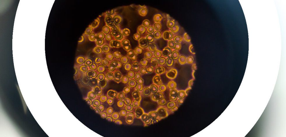 consulta-preliminar-al-mercado-pibicra-andalucia-ia-microscopia